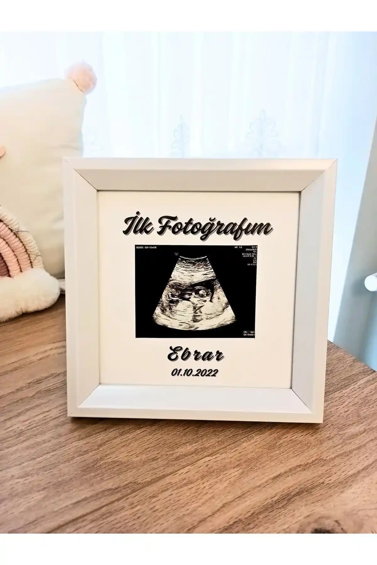 Bebek Odası Dekorasyonunda Anlamlı Ultrason Çerçevesi Seçenekleri ve Tasarım İpuçları