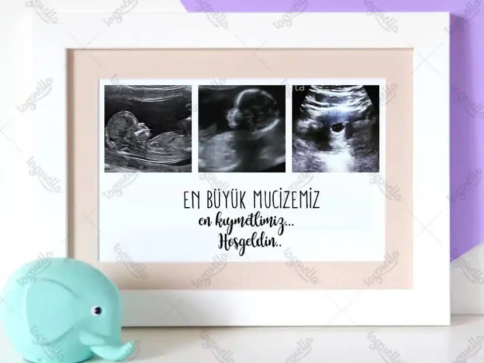 Bebek Odası Dekorasyonunda Ultrason Fotoğraf Çerçevesi Seçenekleri ve Trendler
