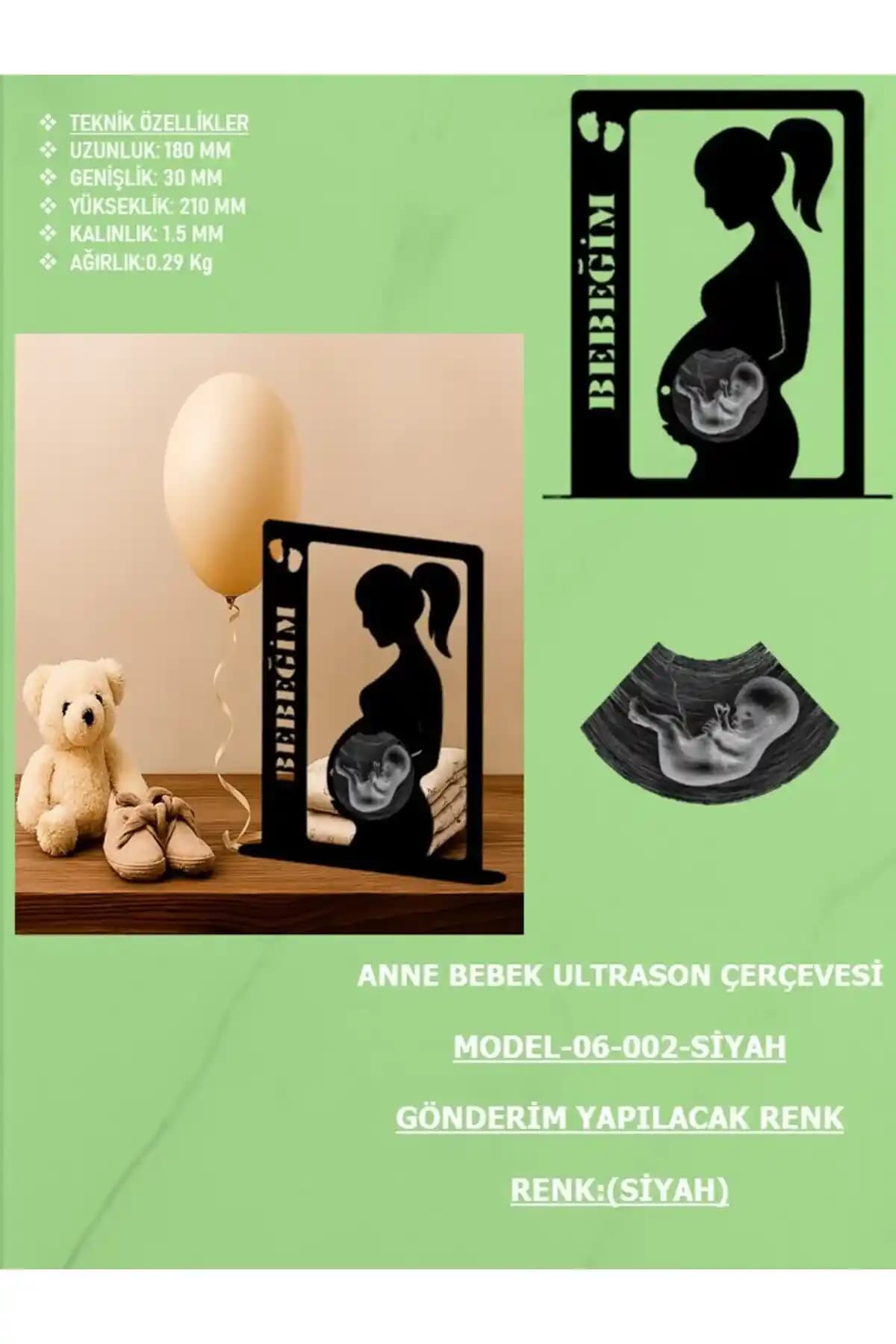 Bebek Ultrason Fotoğraf Çerçevesi: Anlamlı ve Dekoratif Bir Hatıra Seçeneği